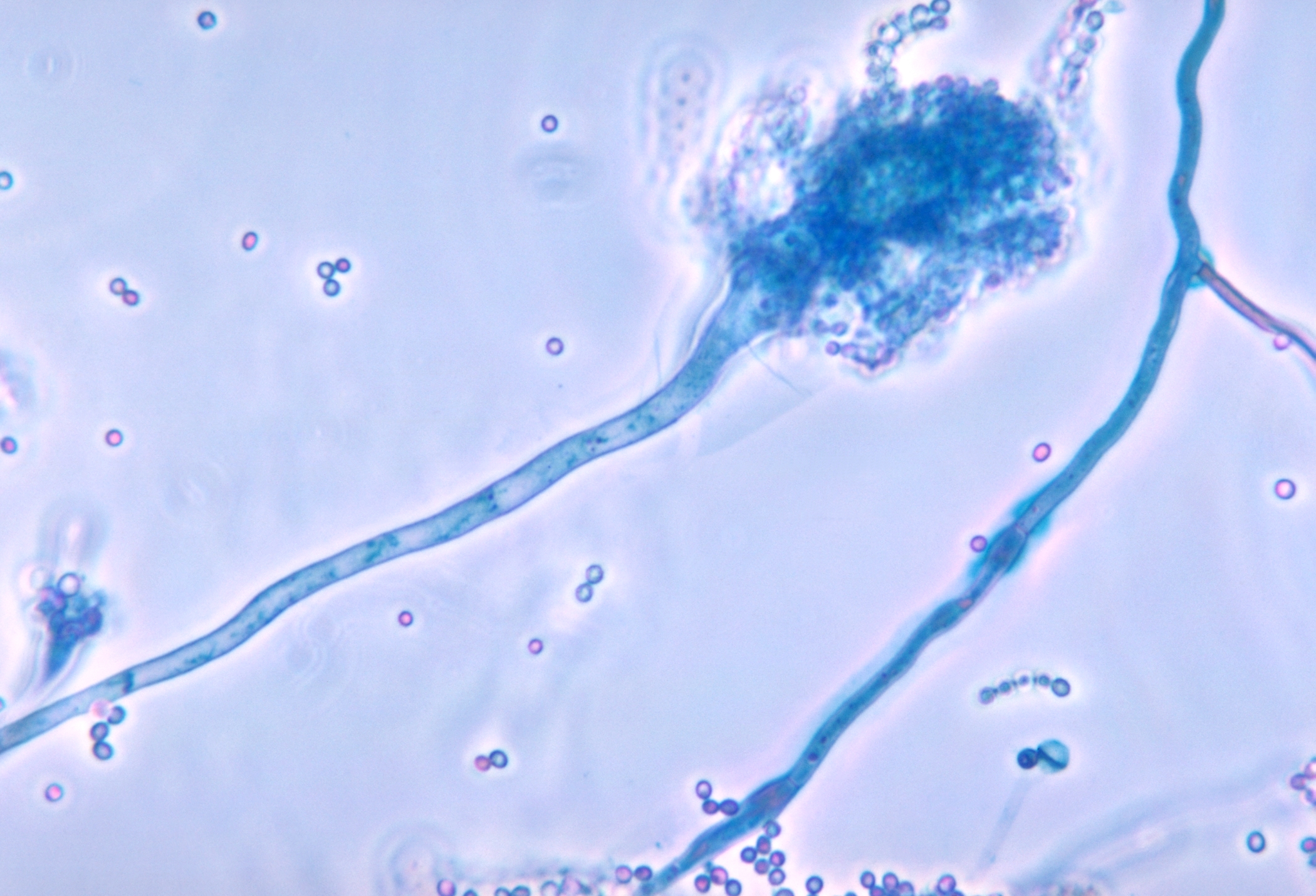 Aspergillus fumigatus pod mikroskopom — pôvodca aspergillózy u papagájov