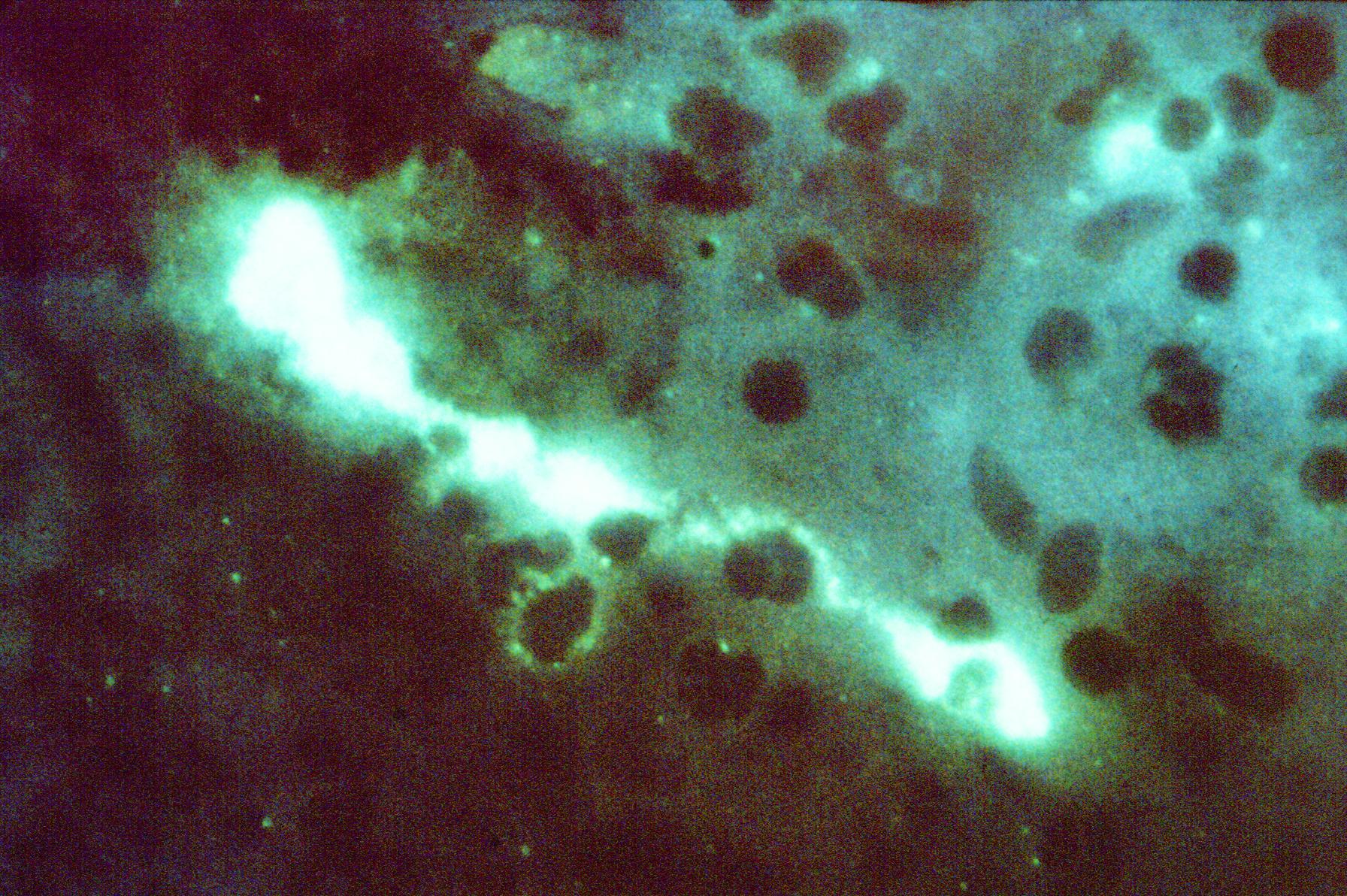 Chlamydia psittaci pod fluorescenčným mikroskopom — pôvodca psitakózy